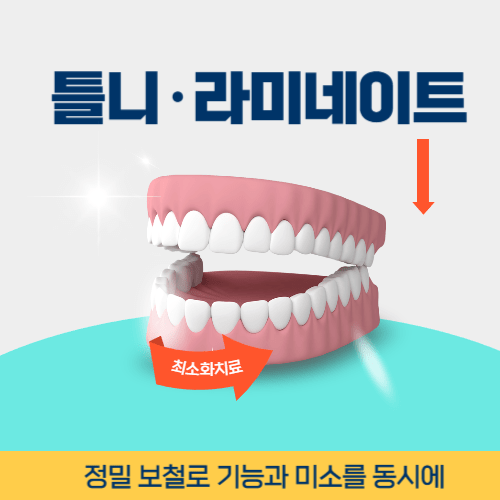 포항치과 포항시 치과 틀니 라미네이트