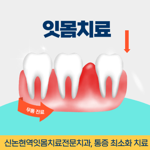 포항치과 포항시 치과 잇몸치료
